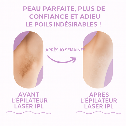 Épilation définitive à domicile, sans douleur